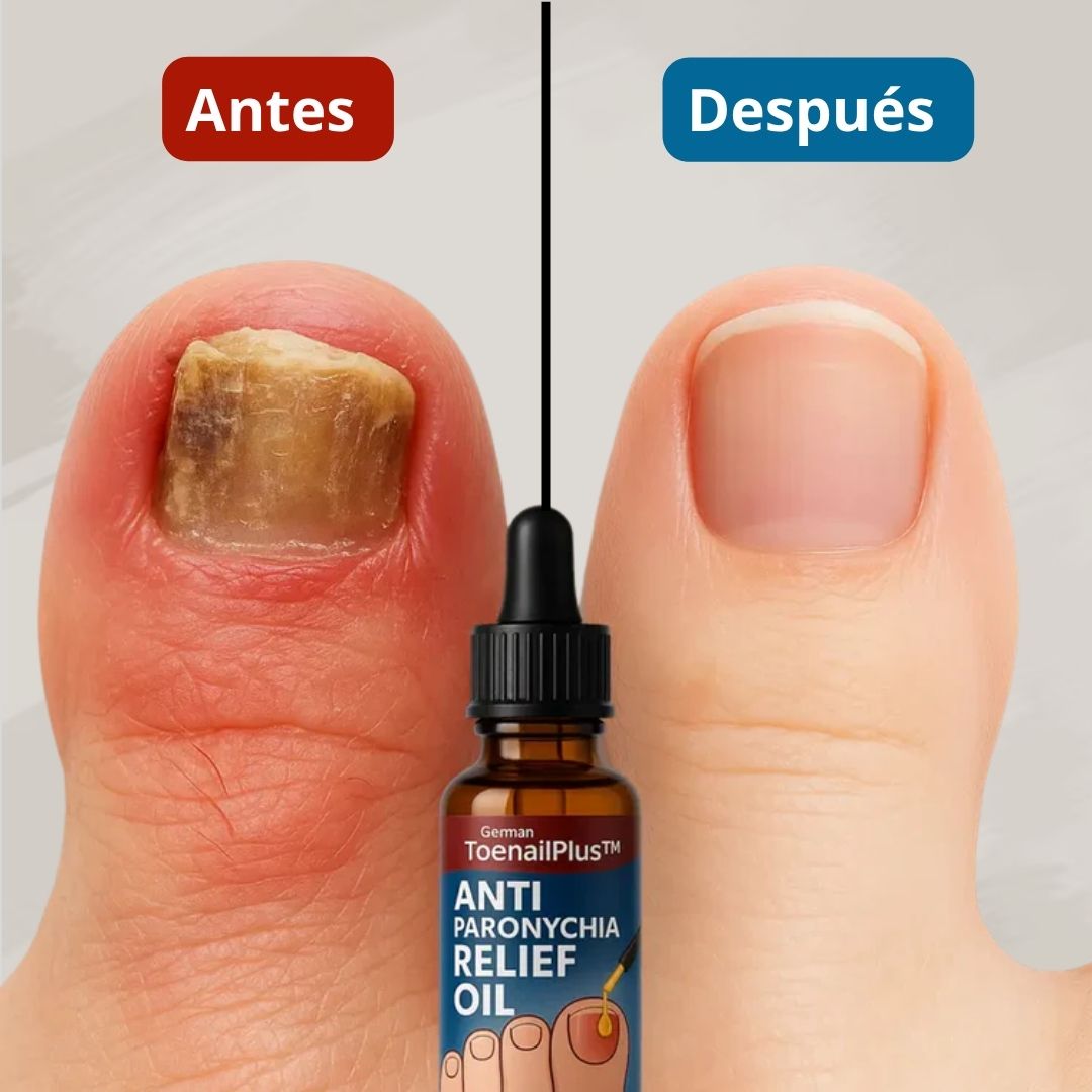 ToenilPlus™ Aceite Antihongos x2 Unidades